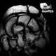 Comorbid EP