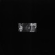 Angel Eyes Trance Edit Single