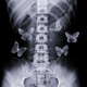 Butterflies Single