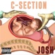 C section Single