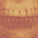 Million Dollar Smile Single