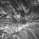 Seizures Single
