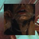 CarcerCityTreatment feat Lockjaw Single