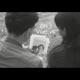 EP1 Vuelve Single