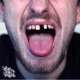 Drugs Booze Dental Issues feat Baileys Brown Badhabitz