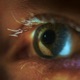 Nystagmus Single