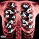 Popcorn Lung Single