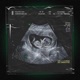 Figlio Del Cash Single