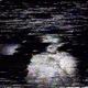 deadlock Single