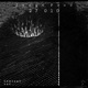27 010 EP