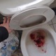 Pooper Single