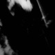 ANEMIA RUINED REMIX Single