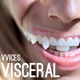 Visceral