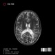 Causes Del Pasado Single