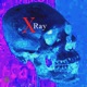 X Ray Single