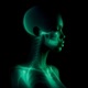 X RAY Single