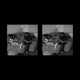 AP feat CB Single