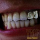 YMF Single