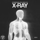 X Ray Single