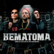 Hematoma feat Kako Single