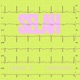 SELAH Single