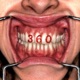 360 Single