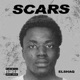 Scars