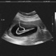 Hoodie Nikes Single
