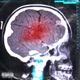 Bad Brainz Single