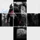 Echo EP