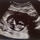 About To Be A Dad feat ExFold Single