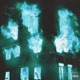 Youphoria