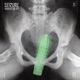Vibrator EP