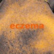 Eczema Single