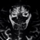 Boltzman Brain Single