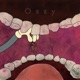 OZZY Single