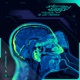 Stray Dogs Kilian Jo Remix Single