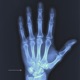 FRACTURE Single