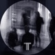 Tar38 Ep