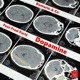 Dopamine feat Fred Parié Single