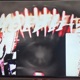 Extension EP
