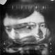 Serendipia EP