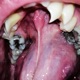 Bruised Grills Eternal Tears EP