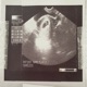 Nameless Single