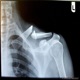 collarbone Single