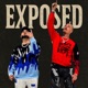 Exposed Single