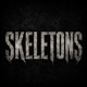 Skeletons Single