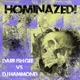Dariush Gee vs DJ Hammond EP