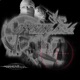 CRYSTAL KILL Single