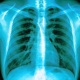 rib cage Single